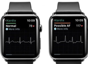 Image result for El sensor de frecuencia cardíaca de Apple Watch